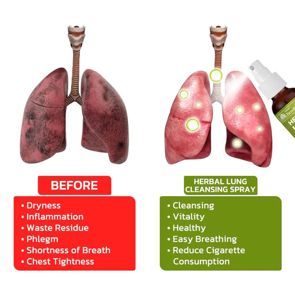 Breath Detox Herbal Lung Cleanse Spray